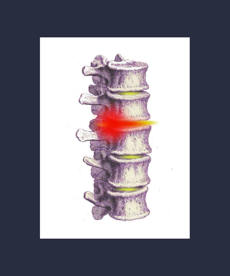 porckorongsérv masszázs